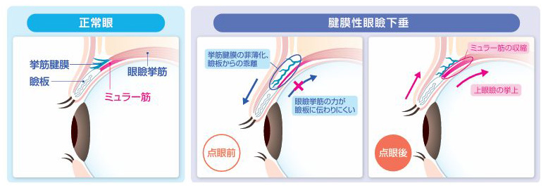 作用機序