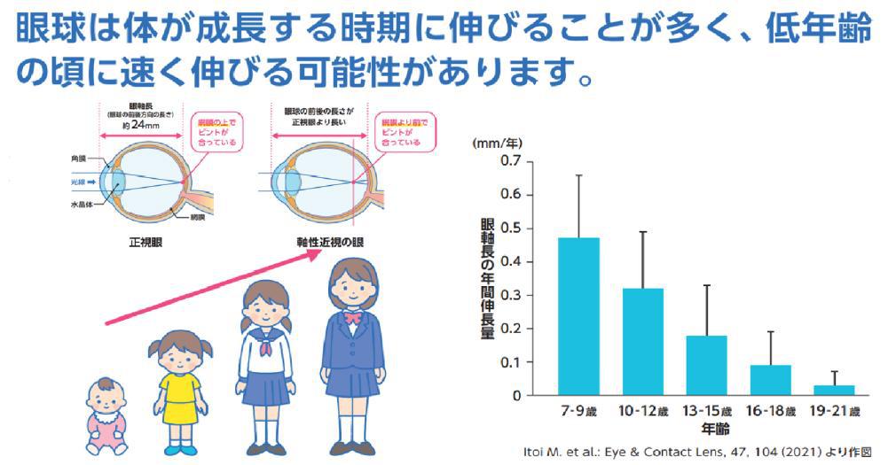 近視の進行時期
