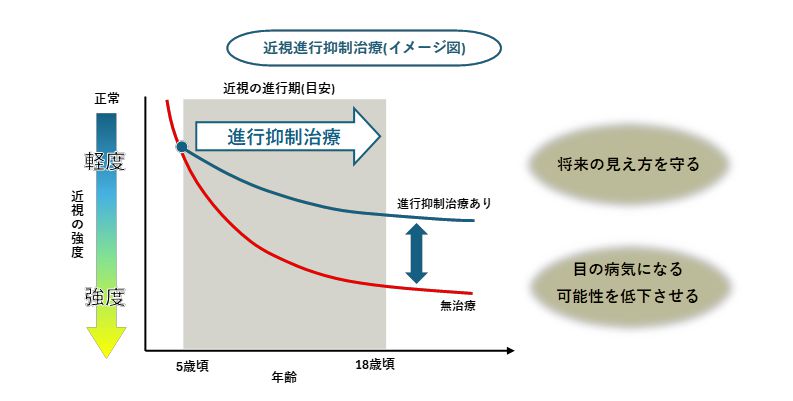 近視進行抑制治療のイメージ図